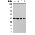 LifeSab™ AKT (pT450) Rabbit pAb (50 µl)