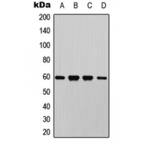 LifeSab™ AKT (pT450) Rabbit pAb (50 µl)