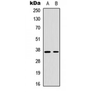 LifeSab™ Cyclin H (pT315) Rabbit pAb (50 µl)