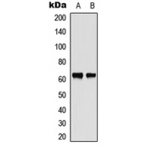 LifeSab™ CHK2 Rabbit pAb (50 µl)