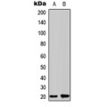 LifeSab™ Zeta COP Rabbit pAb (50 µl)