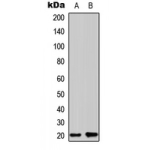 LifeSab™ Zeta COP Rabbit pAb (50 µl)
