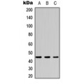LifeSab™ CK2 alpha Rabbit pAb (50 µl)