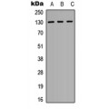 LifeSab™ EPHA2 Rabbit pAb (50 µl)
