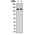 LifeSab™ FGFR1 Rabbit pAb (50 µl)