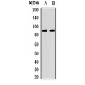 LifeSab™ IKK beta Rabbit pAb (50 µl)