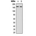 LifeSab™ c-Met Rabbit pAb (50 µl)