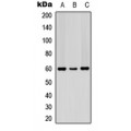 LifeSab™ PDCD4 (pS67) Rabbit pAb (50 µl)