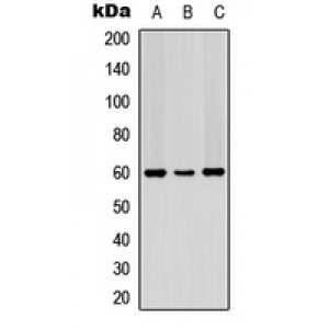 LifeSab™ PDCD4 (pS67) Rabbit pAb (50 µl)