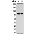 LifeSab™ c-Raf/B-RAF (pT491/599) Rabbit pAb (50 µl)