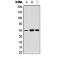 LifeSab™ Angiopoietin-1 Rabbit pAb (50 µl)