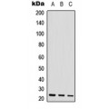 LifeSab™ POLR3H Rabbit pAb (50 µl)