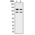 LifeSab™ CDK11B Rabbit pAb (50 µl)