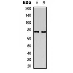 LifeSab™ ACSS1 Rabbit pAb (50 µl)