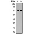 LifeSab™ TGFBR2 Rabbit pAb (50 µl)