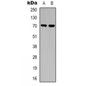 LifeSab™ TGFBR2 Rabbit pAb (50 µl)