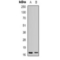 LifeSab™ LMO3 Rabbit pAb (50 µl)
