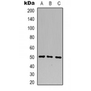 LifeSab™ B4GALT1 Rabbit pAb (50 µl)