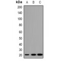 LifeSab™ TRAPPC5 Rabbit pAb (50 µl)