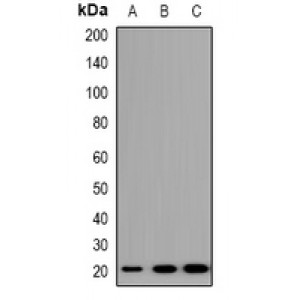 LifeSab™ TRAPPC5 Rabbit pAb (50 µl)