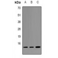 LifeSab™ Alpha-synuclein (pY125) Rabbit pAb (50 µl)