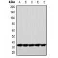 LifeSab™ CNOT7 Rabbit pAb (50 µl)
