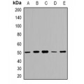 LifeSab™ GDI2 Rabbit pAb (50 µl)