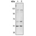 LifeSab™ ITPKA Rabbit pAb (50 µl)