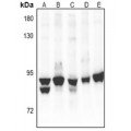 LifeSab™ PKC alpha Rabbit pAb (50 µl)
