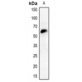 LifeSab™ CHK2 Rabbit pAb (50 µl)