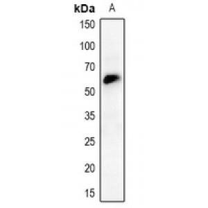 LifeSab™ CHK2 Rabbit pAb (50 µl)