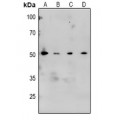 LifeSab™ CaMK2 alpha/beta/delta (pT305) Rabbit pAb (50 µl)