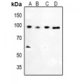 LifeSab™ Glucocorticoid Receptor (pS226) Rabbit pAb (50 µl)