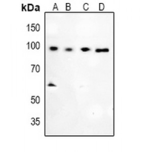 LifeSab™ Glucocorticoid Receptor (pS226) Rabbit pAb (50 µl)
