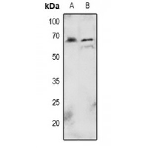 LifeSab™ AKT (pT72) Rabbit pAb (50 µl)