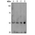 LifeSab™ TPH1 (pS58) Rabbit pAb (50 µl)