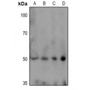 LifeSab™ TPH1 (pS58) Rabbit pAb (50 µl)