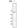 LifeSab™ Estrogen Receptor alpha Rabbit pAb (50 µl)