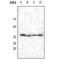 LifeSab™ AMPK gamma 1/2/3 Rabbit pAb (50 µl)