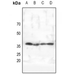 LifeSab™ AMPK gamma 1/2/3 Rabbit pAb (50 µl)