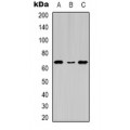 LifeSab™ Estrogen Receptor alpha (pS104) Rabbit pAb (50 µl)