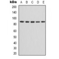 LifeSab™ IKK alpha/beta Rabbit pAb (50 µl)