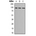 LifeSab™ Focal Adhesion Kinase (pY407) Rabbit pAb (50 µl)