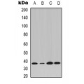 LifeSab™ IKB alpha (pY42) Rabbit pAb (50 µl)