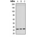 LifeSab™ RPS6 Rabbit pAb (50 µl)