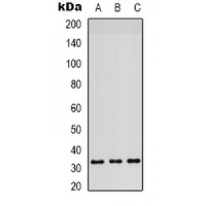 LifeSab™ RPS6 Rabbit pAb (50 µl)