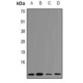 LifeSab™ SOCS2 Rabbit pAb (50 µl)