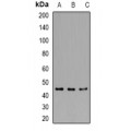 LifeSab™ CK1 alpha Rabbit pAb (50 µl)