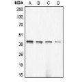 LifeSab™ Alpha-actin-3 Rabbit pAb (50 µl)