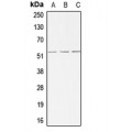 LifeSab™ ALK1 Rabbit pAb (50 µl)
